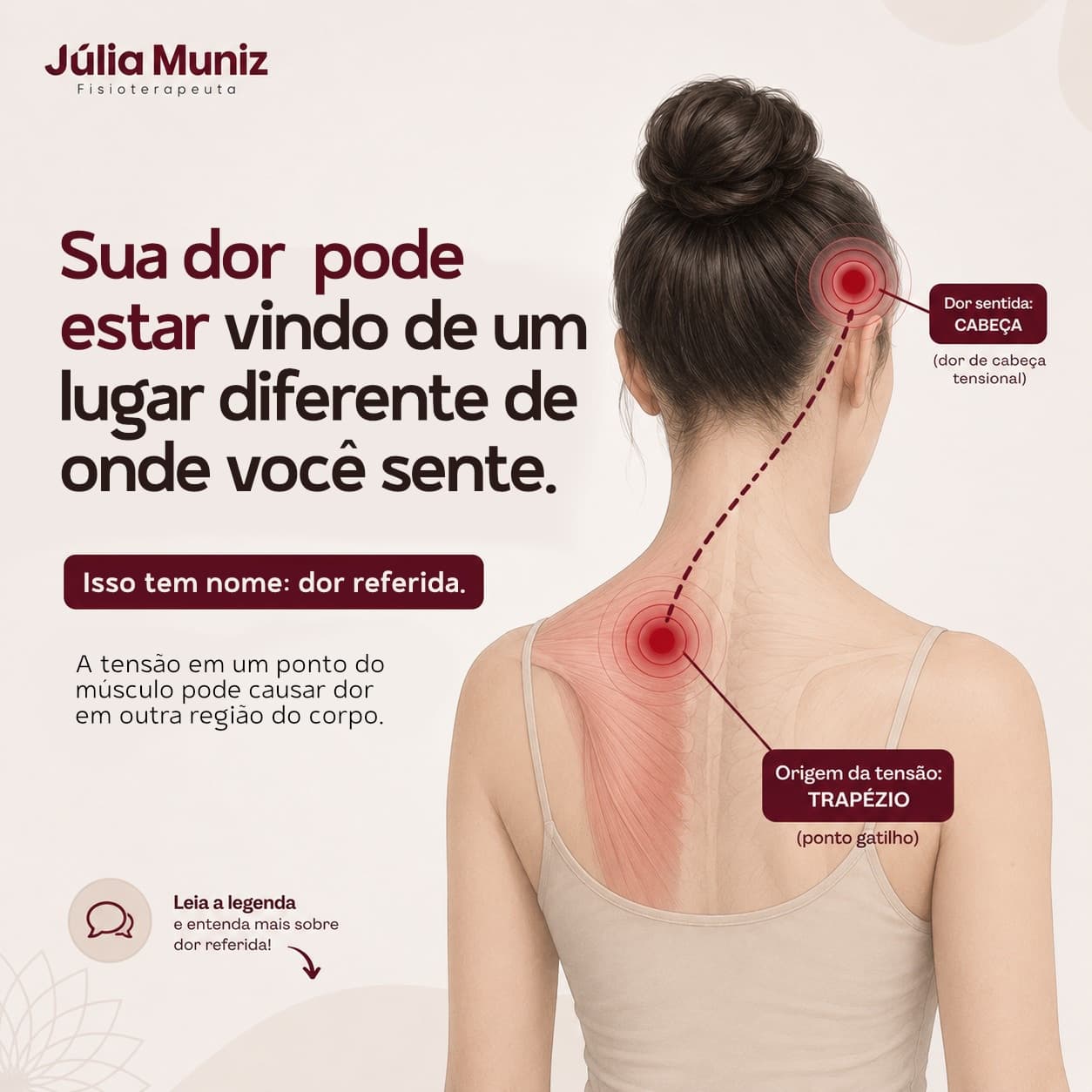 Arte do Instagram da Júlia: pessoa de costas com dois pontos vermelhos, um no trapézio e outro na cabeça, ligados por uma linha tracejada. Título: sua dor pode estar vindo de um lugar diferente de onde você sente.