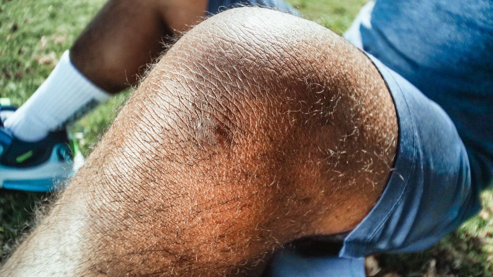 Corredor com a mão sobre o joelho após sentir dor durante o treino ao ar livre